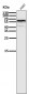 Anti-ER alpha ESR1 Rabbit Monoclonal Antibody